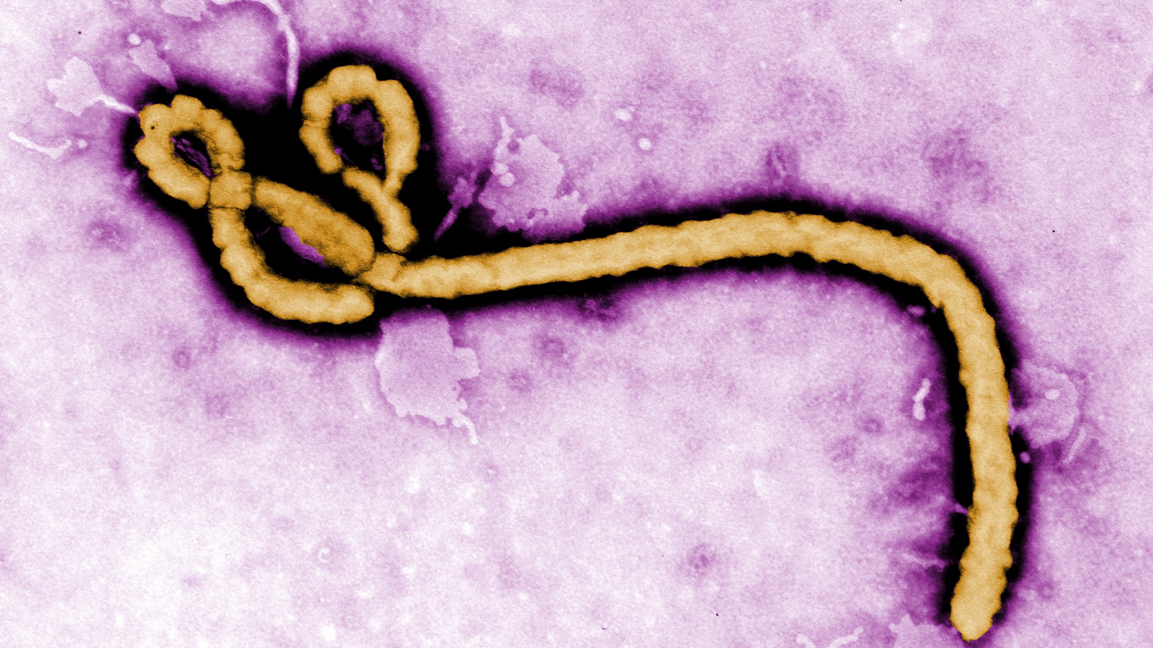 Cross River takes steps to prevent Ebola outbreak at borders