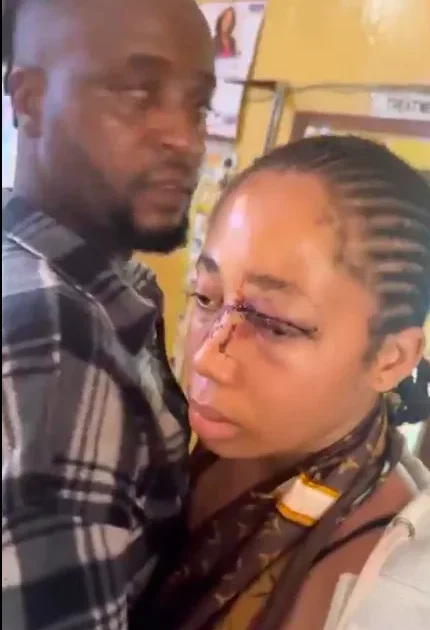 Injured 18-Year-Old Wife Asks Not to Arrest Husband Amid Abuse Videos
