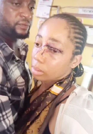 Man held in Lagos for attacking his young wife