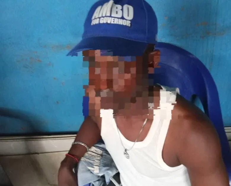 Osun Police Investigate Shooting of APC Member
